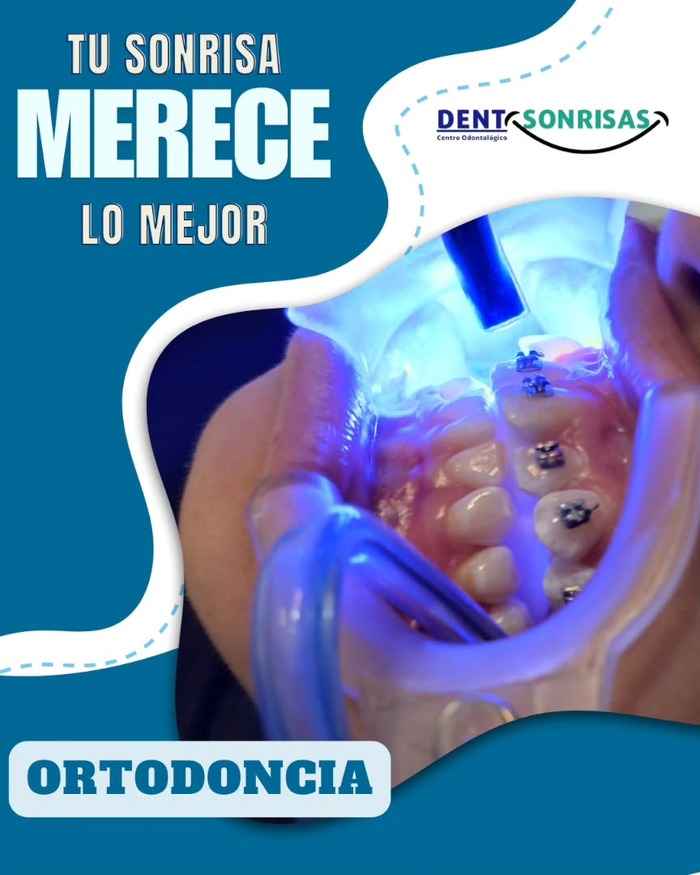 Dent Sonrisas